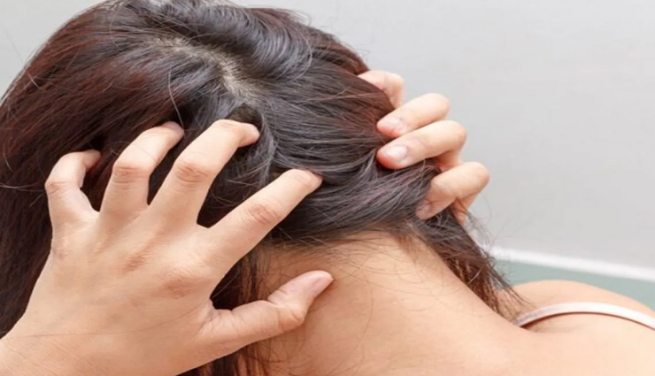 beauty tips,beauty tips in hindi,hair care tips,bay leaf for hair