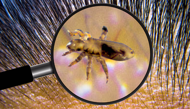 shikakai powder,shikakai powder for hair,shikakai powder benefits for hair,shikakai for hair,benefits of shikakai for hair,hair care tips,hair beauty