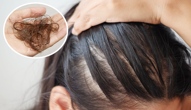 7 Natural and Effective Ways To Treat Hair Loss