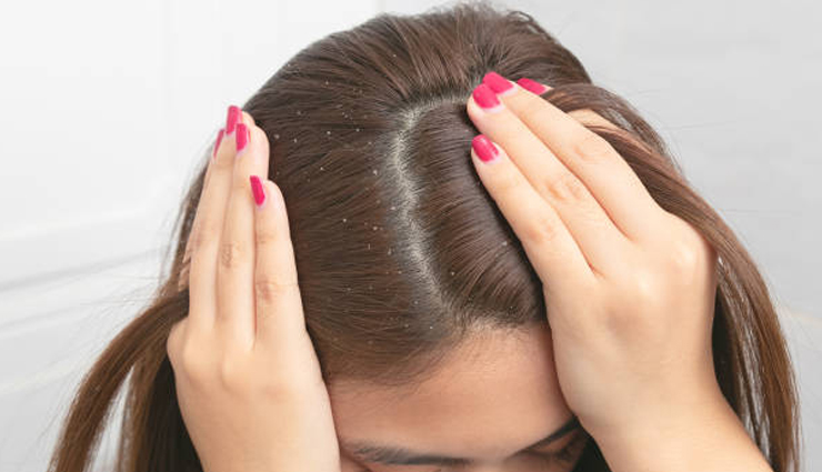 common hair problems,common hair problems in monsoon,monsoon hair care tips,beauty tips