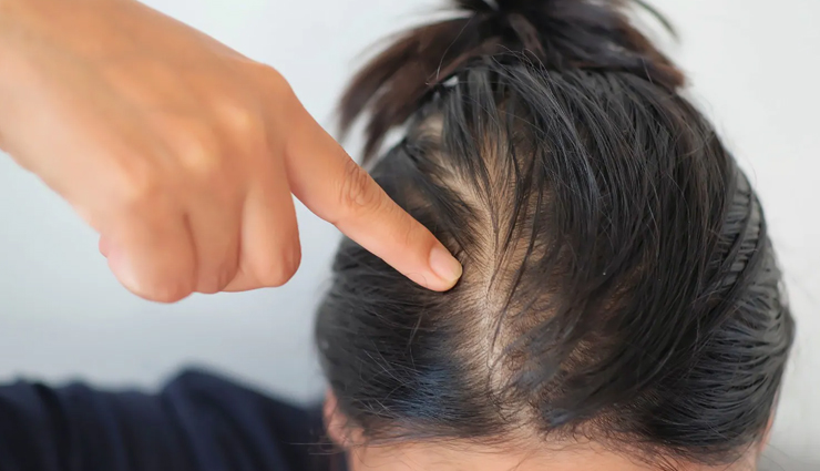 common hair problems,common hair problems in monsoon,monsoon hair care tips,beauty tips