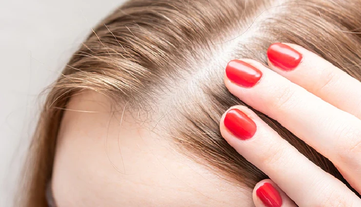6 Natural Ways To Strengthen Your Hair Roots
