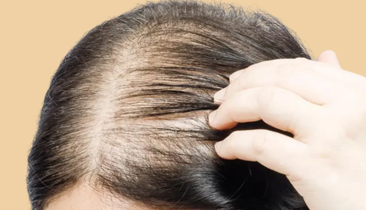 hair thinning causes,bad hair habits,hair loss in women,how to prevent hair fall,hair care tips,healthy hair routine,hair maintenance hacks,habits that damage hair,stop hair thinning,natural hair care tips