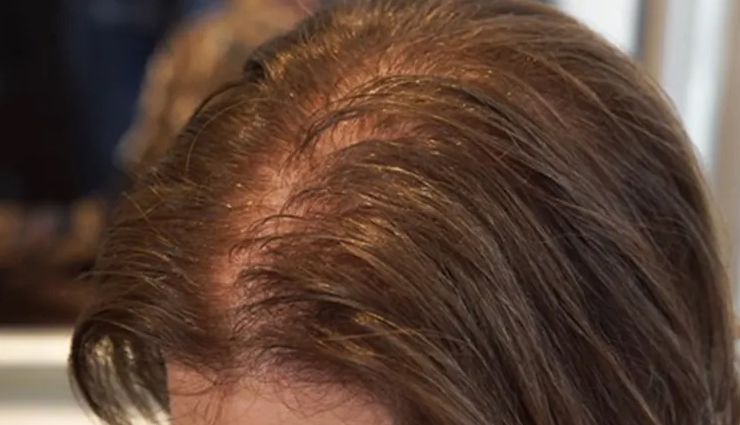 hair problems,diy tonics for hair problems,hair care tips,beauty tips