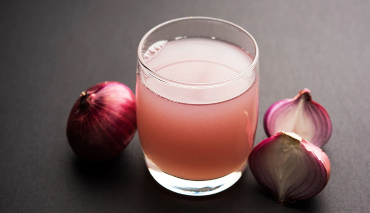 lice problem becomes a problem for hair,try these home remedies,beauty tips,beauty hacks