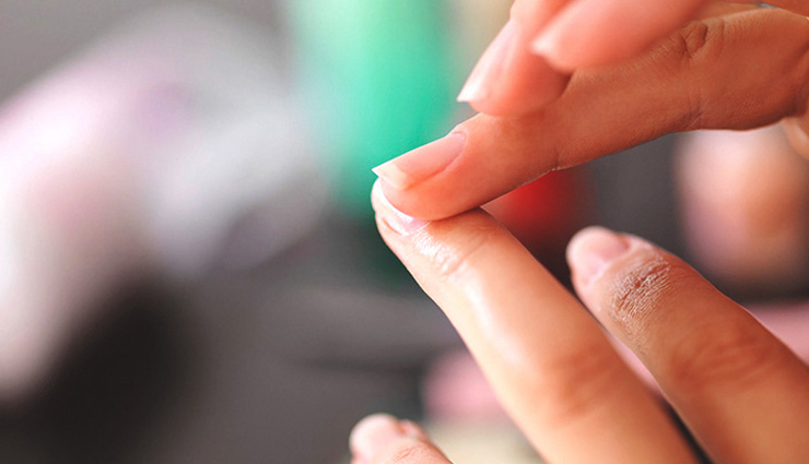 3 Effective Tips to Treat and Avoid Hangnails