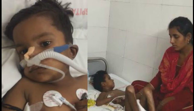 चाउमीन खाने के बाद 3 साल के बच्चे के फेफड़े फटे, डॉक्टर बोले- स्वाद बढ़ाने के चक्कर में जान से खेल रहे है दुकानदार