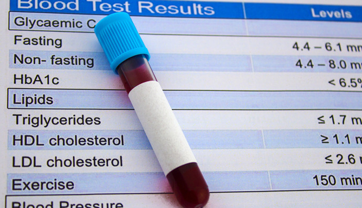 Hazelnuts,health benefits of hazelnuts,Health tips,fitness tips