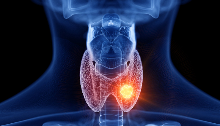 hazelnuts health benefits,benefits of eating hazelnuts,hazelnut nutrition benefits,health benefits of hazelnut nuts,amazing hazelnut health benefits,hazelnuts for health and wellness,nutritional value of hazelnuts,hazelnuts and their health advantages,hazelnut benefits for the body,why hazelnuts are healthy,antioxidants in hazelnuts,essential nutrients in hazelnuts,hazelnuts vitamin content,minerals in hazelnuts,hazelnuts dietary fiber,polyphenols in hazelnuts,heart health benefits of hazelnuts,brain-boosting hazelnut benefits,skin benefits of hazelnuts,hazelnuts and weight management