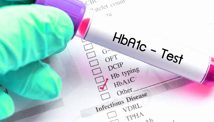 9 Ways To Help You Lower Your A1C Levels