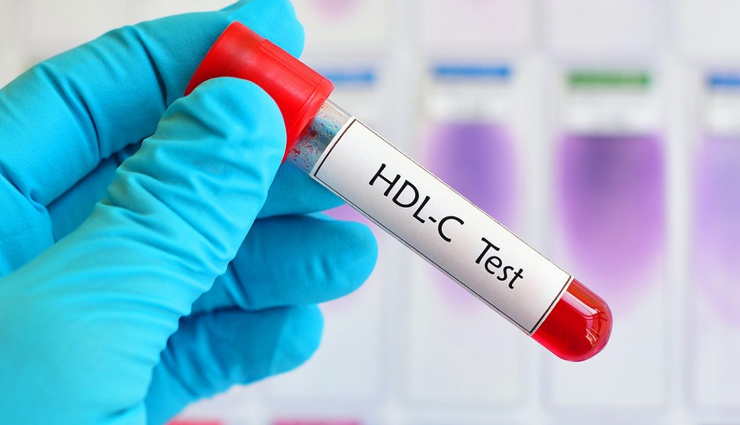 5 Tips To Help You Increase HDL Cholesterol Naturally