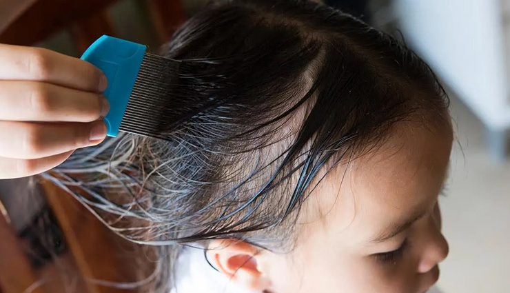 head lice,home remedies for head lice,natural remedies for head lice,hair care tips,beauty tips,summer tips