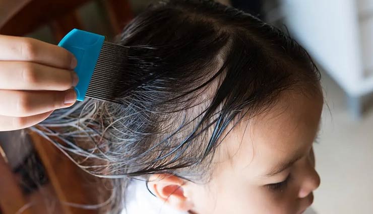 4 Ways To Use Apple Cider Vinegar To Kill Head Lice
