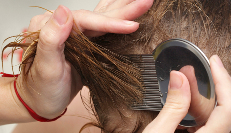 15 Natural Ways To Get Rid of Head Lice