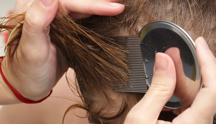 5 Myths About Head lice You Should Not Believe
