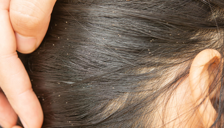 neem oil for hair growth,neem oil for dandruff treatment,benefits of neem oil for hair,neem oil for scalp health,neem oil for hair loss prevention,neem oil for hair conditioning,neem oil for treating scalp infections,neem oil for hair strengthening,neem oil for promoting hair thickness,neem oil for natural hair care