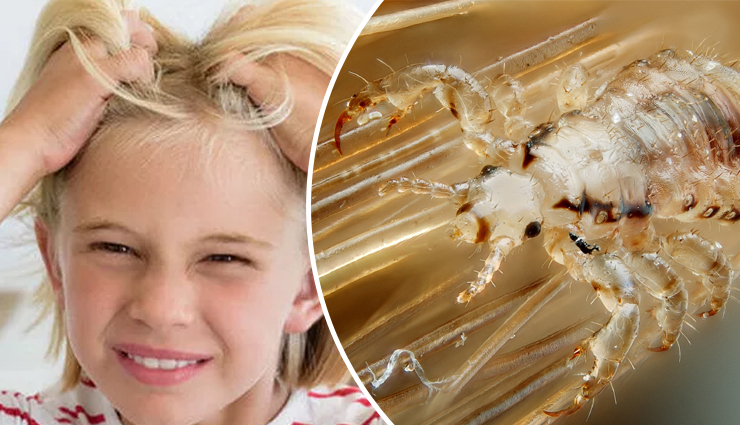 clove water for hair care,hidden benefits of clove water for hair,clove water hair treatment,clove water for hair growth,clove water for dandruff control,how to use clove water for hair,clove water hair rinse,clove water for scalp health,clove water hair mask,clove water vs. other hair remedies,clove water for hair shine,diy clove water hair treatments,clove water for hair thickness,clove water hair strengthening,clove water for split ends,clove water for hair follicles,clove water hair detox,clove water for natural hair care,benefits of clove water for damaged hair,clove water for least known hair benefits