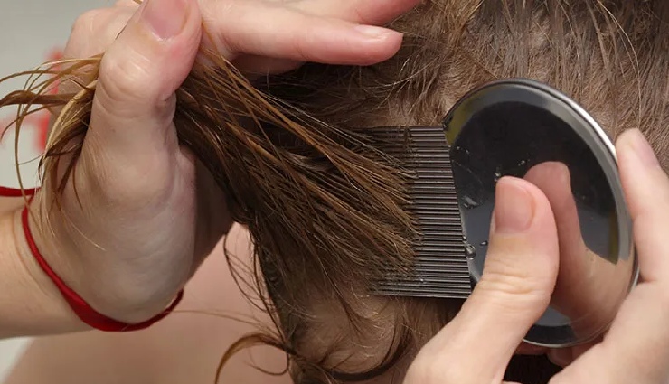 itchy scalp causes,itchy scalp treatment,scalp irritation,how to stop scalp itching,hair care tips for itchy scalp,summer scalp care,scalp hygiene,dermatologist scalp advice