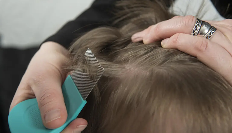 head lice,home remedies for head lice,natural remedies for head lice,hair care tips,beauty tips,summer tips