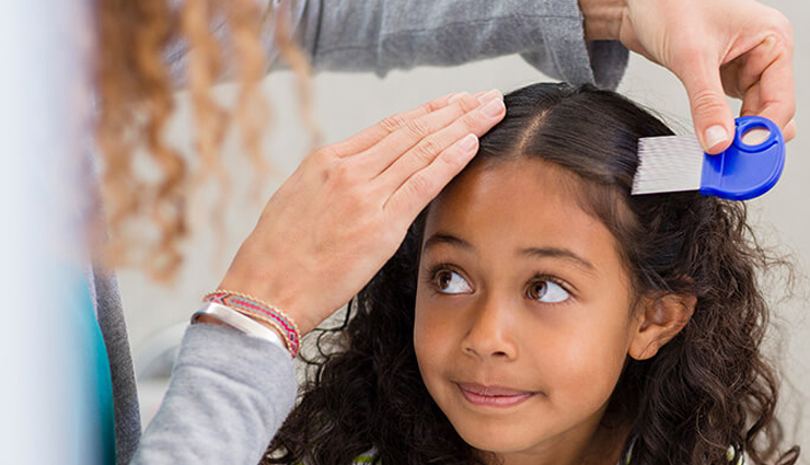 head lice,home remedies for head lice,natural remedies for head lice,hair care tips,beauty tips,summer tips