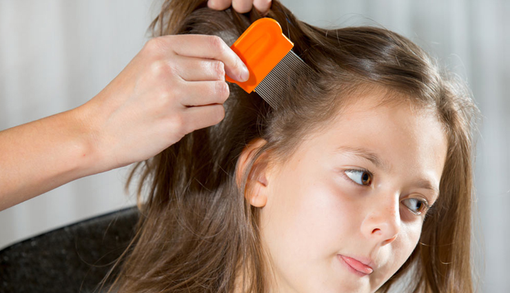 head lice,home remedies for head lice,hair care tips,beauty tip