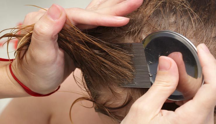 beauty tips,beauty tips in hindi,head lice remedies,home remedies