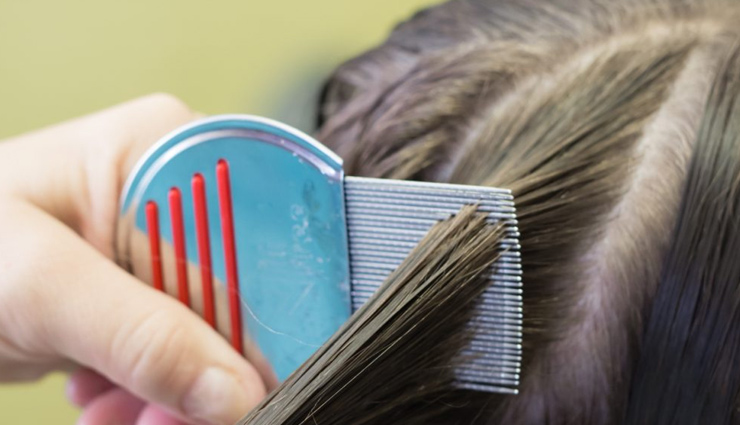 natural remedies,natural remedies to get rid of head lice,head lice,hair care tips,beauty tips