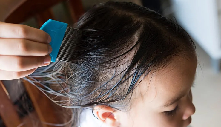 natural remedies,natural remedies to get rid of head lice,head lice,hair care tips,beauty tips
