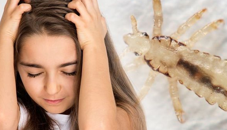 myths about head lice you should not believe,beauty tips,beauty hacks