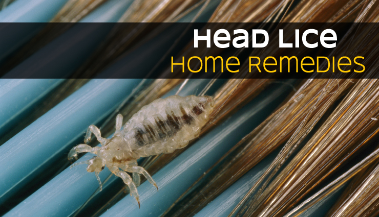 7 Home Remedies To Get Rid of Head Lice