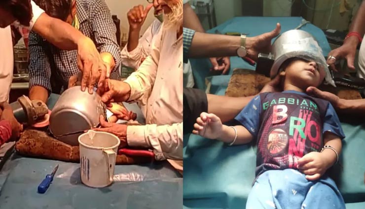 प्रेशर कुकर बना बच्चे की जान का आफत, सिर में फंसने से हुआ बुरा हाल 