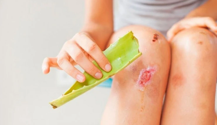 aloe vera benefits,aloe vera for skin,aloe vera for hair,aloe vera gel uses,aloe vera for acne,aloe vera for sunburn,aloe vera home remedies,natural skincare with aloe vera,aloe vera for dry skin,aloe vera for glowing skin,aloe vera for dandruff,aloe vera for hair growth