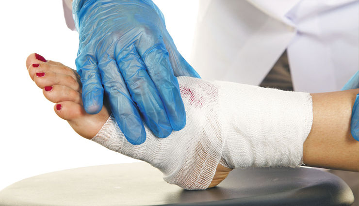 annatto,annatto health benefits,annatto benefits,Health,Health tips