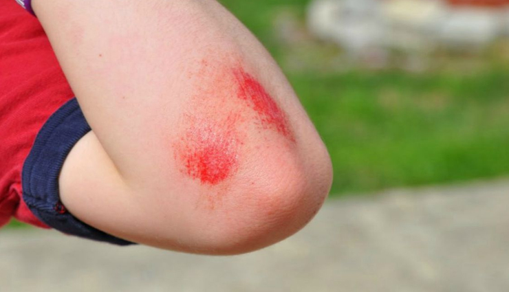 pear,pear health benefits,healthy living,Health tips,pear health tips