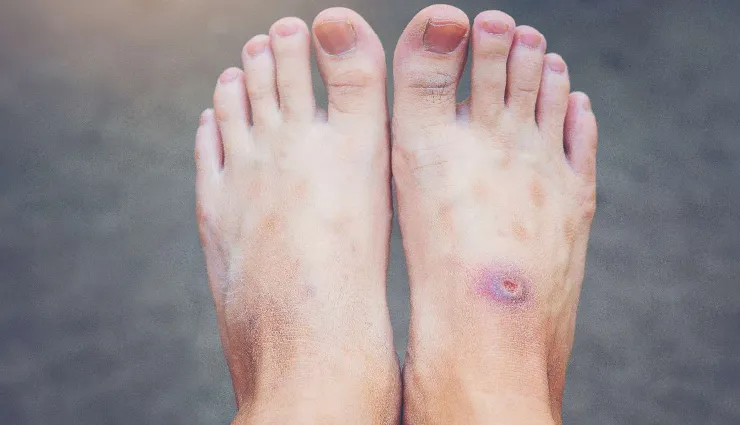 prediabetes symptoms,borderline diabetes signs,high blood sugar warning,early diabetes detection,prevent type 2 diabetes,fasting blood sugar levels,prediabetic stage,diabetes risk factors,heart and kidney health,prediabetes management