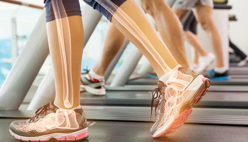 16 Home Remedies and Natural Ways to Keep Bones Healthy