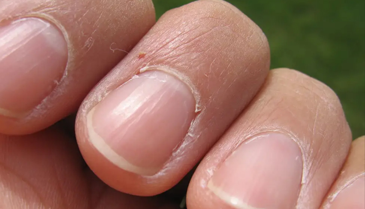 vitamin e capsules for skin,skin care tips,vitamin e capsules for skin whitening,vitamin e capsules for face,vitamin e capsules for skin,uses of vitamin e capsules,how to use vitamin e capsules for face,vitamin e capsules benefits,benefits of vitamin e capsules,how to use vitamin e capsules for skin whitening,skin care tips,beauty,beauty tips