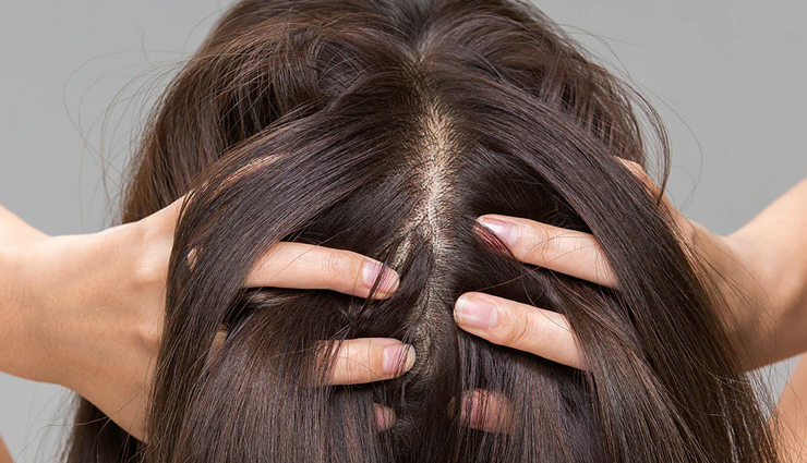 5 Must Try Remedies To Get Healthy Hair 