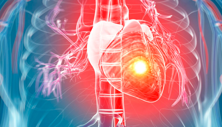 world heart day,common causes of heart attack,causes of heart attack in young adult,Health tips,fitness tips