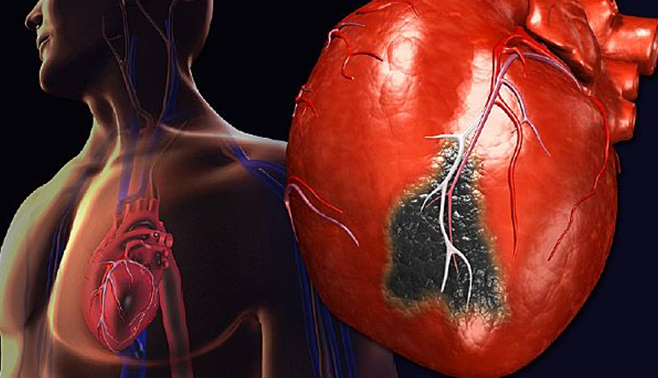 world heart day,common causes of heart attack,causes of heart attack in young adult,Health tips,fitness tips