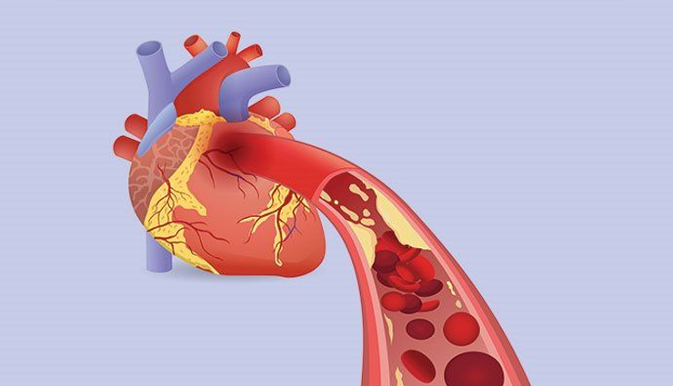 world heart day,common causes of heart attack,causes of heart attack in young adult,Health tips,fitness tips