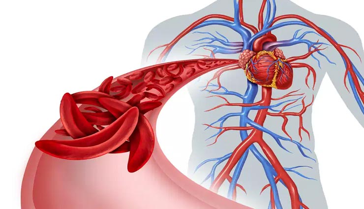 हार्ट ब्लॉकेज की समस्या में ये आहार बनेंगे आपका सहारा, होगी धमनियों की सफाई