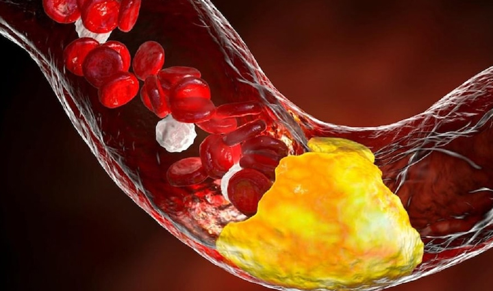 बुजुर्गों के साथ युवाओं को भी परेशान कर रही दिल की बीमारियां, इन टिप्स से रखें हार्ट को हेल्दी heart diseases are troubling the youth along with the elderly keep the heart healthy with these tips,Health,healthy living