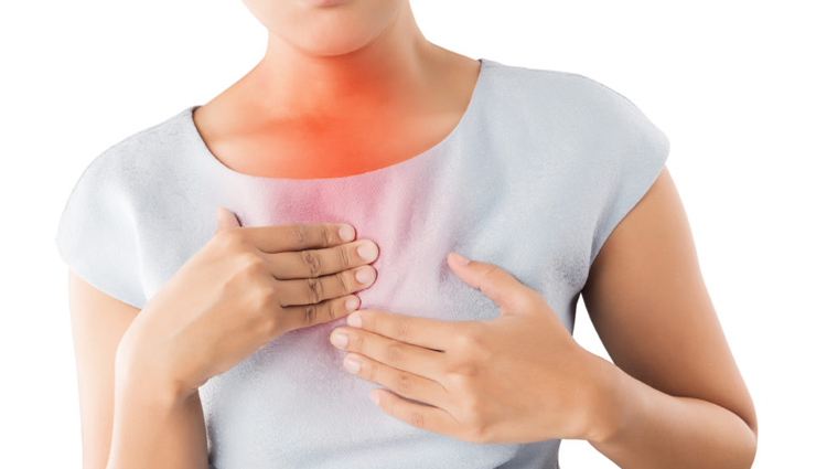 5 Home Remedies To Treat Heartburn During Summers