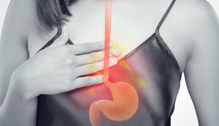 6 Most Common Remedies To Treat Heartburn