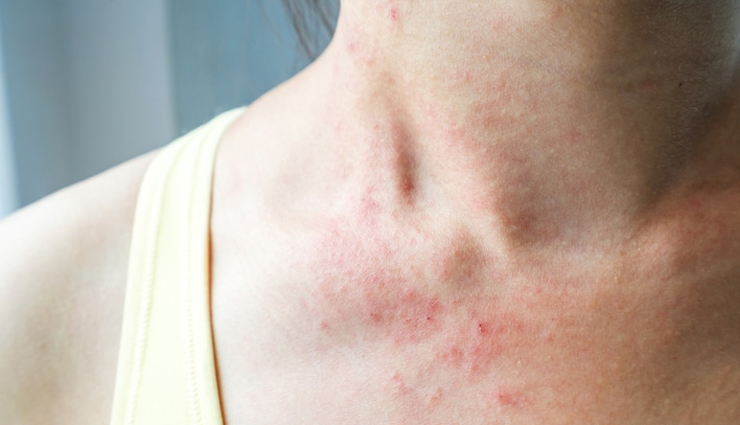 ice cube facial benefits,skin benefits of rubbing ice on face,amazing effects of ice cubes for skin,ice cube beauty hacks for your face,refreshing ice cube face treatment,benefits of cold compress for facial skin,how ice cubes improve skin health,ice facial for glowing skin,cool ice massage for your face,ice cubes in skincare routine