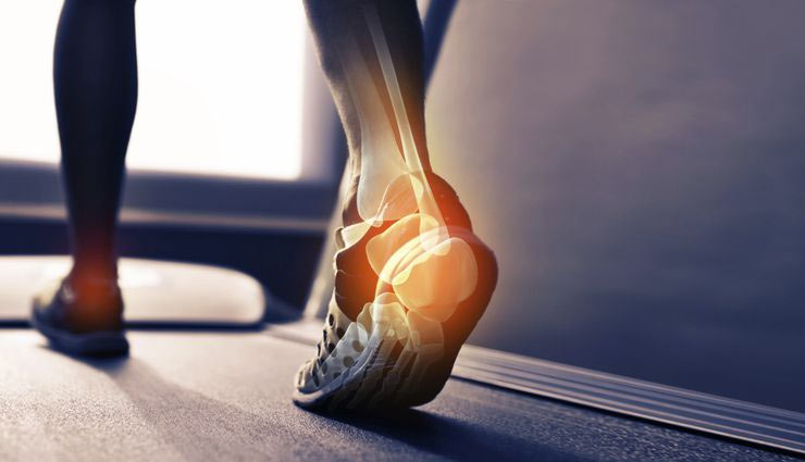 मिनटों में मिलेगी एड़ियों के दर्द से राहत, आजमाए ये बेहतरीन उपाय 