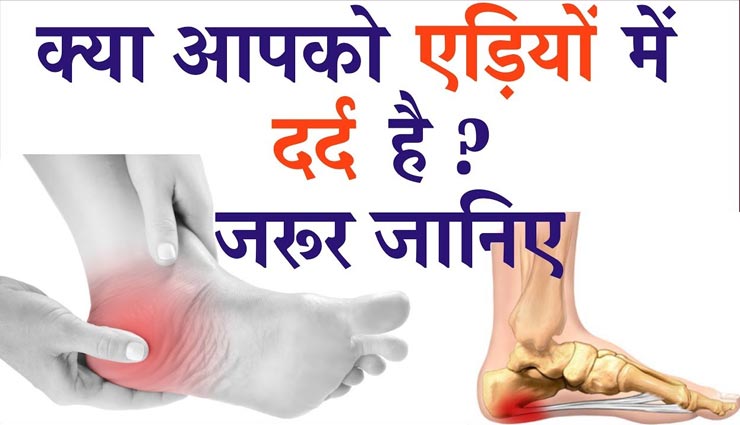 लम्बे वक्त से परेशानी बना हुआ हैं एडियों का दर्द, इन तरीकों से मिलेगा आराम