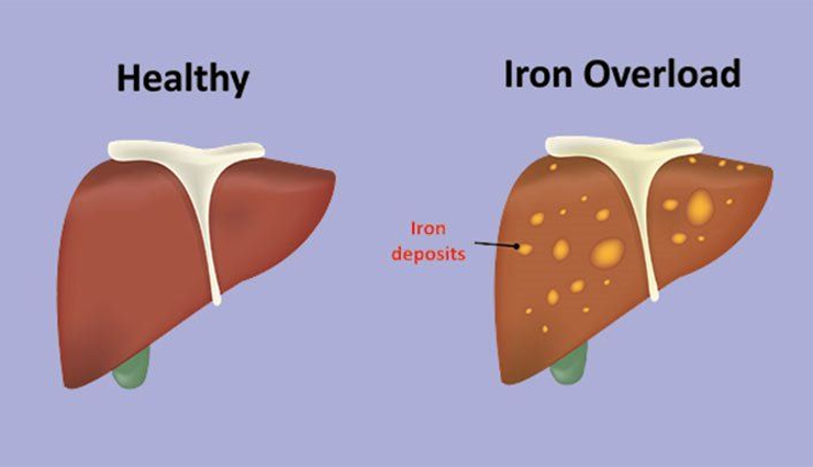 health benefits of donating blood,donating blood on regular basis,blood donation tips,donating blood regularly,blood donation for good health,Health,Health tips