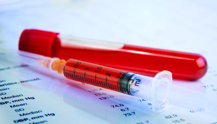 world blood donor day,not eligible to donate blood,blood donation restrictions,ineligible blood donors,who can not donate blood,blood donation contraindications,blood donation disqualifications,blood donor eligibility criteria,health conditions and blood donation,blood donor exclusion criteria,reasons for not donating blood